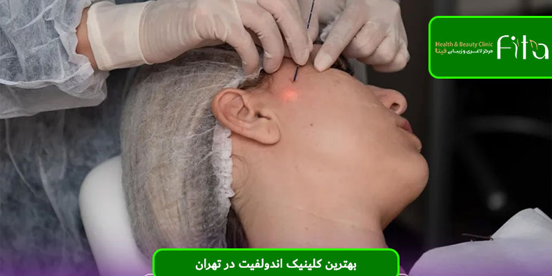 بهترین کلینیک اندولفیت در تهران