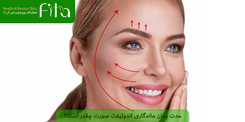 مدت زمان ماندگاری اندولیفت صورت چقدر است؟