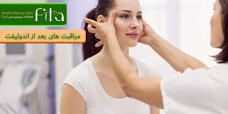 مراقبت های بعد از اندولیفت