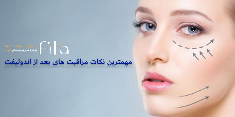مهمترین نکات مراقبت های بعد از اندولیفت لاغری