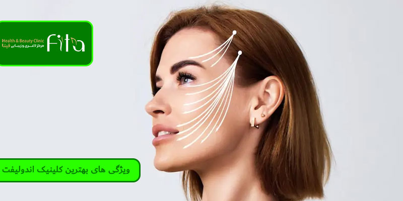 ویژگی های بهترین کلینیک اندولیفت