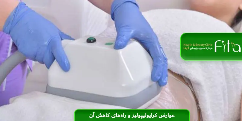 عوارض کرایولیپولیز و راه‌های کاهش آن