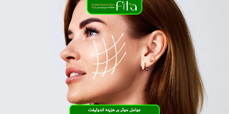 عوامل موثر بر هزینه اندولیفت