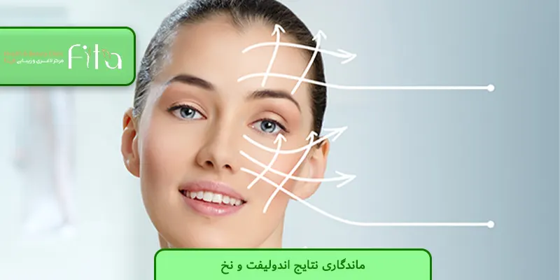 ماندگاری نتایج اندولیفت و نخ