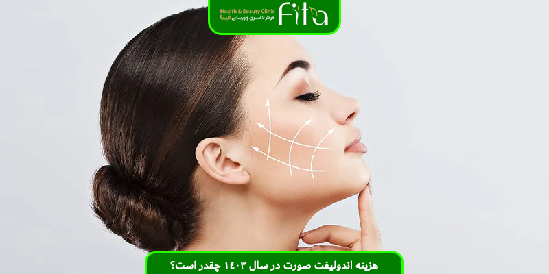 هزینه اندولیفت صورت در سال 1403 چقدر است؟