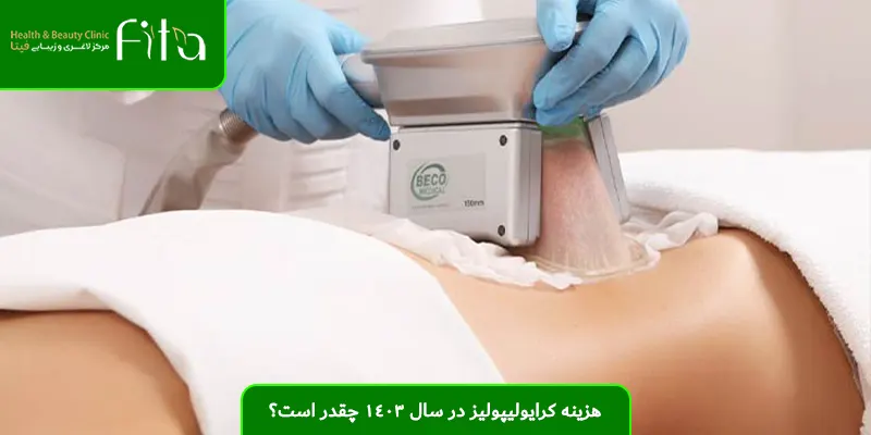 هزینه کرایولیپولیز در سال 1403 چقدر است؟