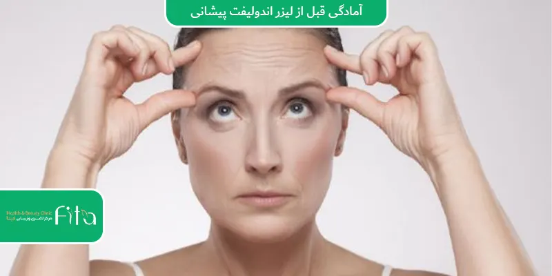 آمادگی قبل از لیزر اندولیفت پیشانی
