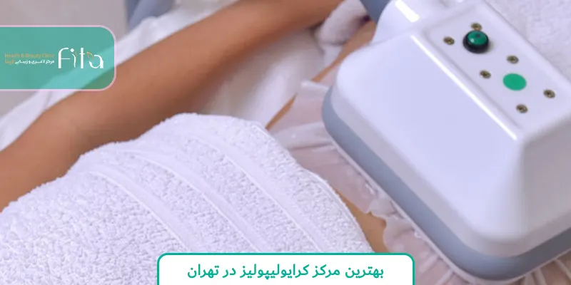 بهترین مرکز کرایولیپولیز در تهران