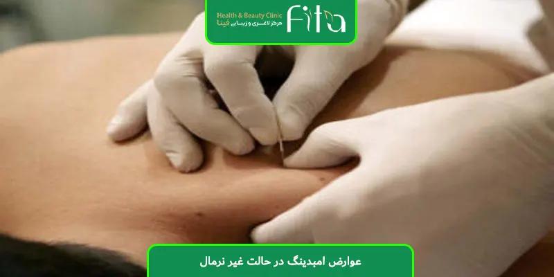 عوارض امبدینگ در حالت غیر نرمال