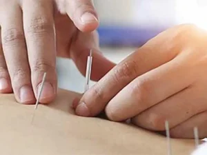 عوارض کاشت نخ لاغری