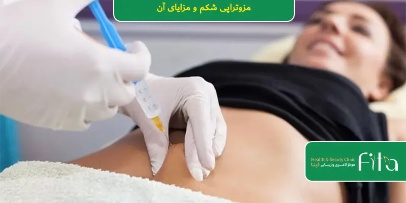 مزوتراپی شکم و مزایای آن