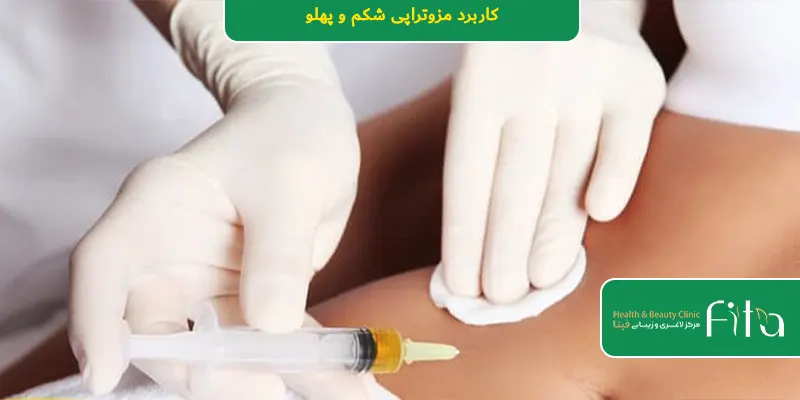 کاربرد مزوتراپی شکم و پهلو