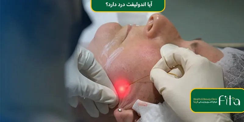 آیا اندولیفت درد دارد؟