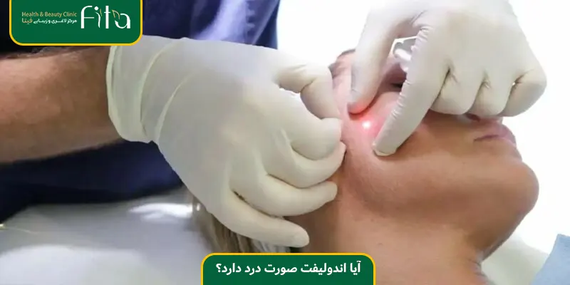 آیا اندولیفت صورت درد دارد؟