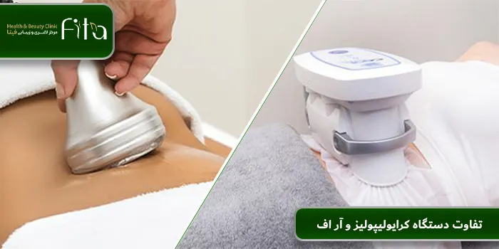 تفاوت دستگاه کرایولیپولیز و آر اف
