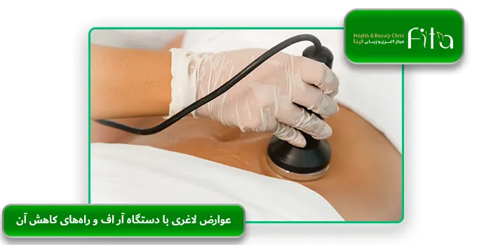 عوارض لاغری با دستگاه آر اف و راه‌های کاهش آن