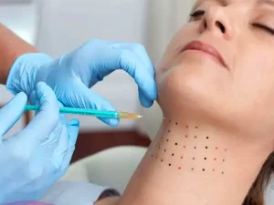 مزوتراپی غبغب