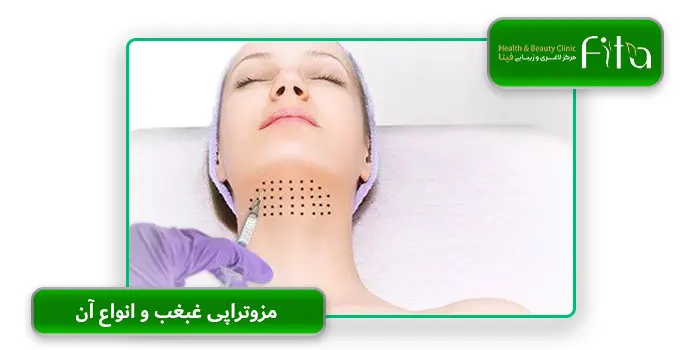 مزوتراپی غبغب و انواع آن