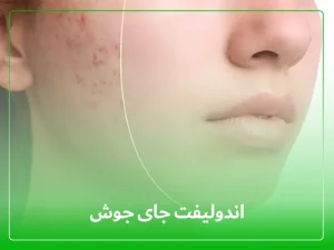 اندولیفت جای جوش