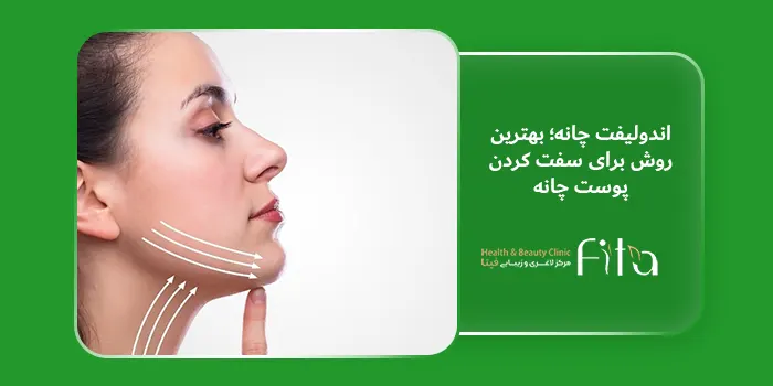 اندولیفت چانه؛ بهترین روش برای سفت کردن پوست چانه 