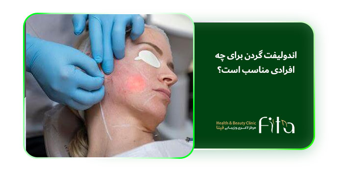 اندولیفت گردن برای چه افرادی مناسب است؟