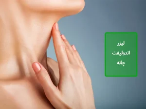 لیزر اندولیفت چانه