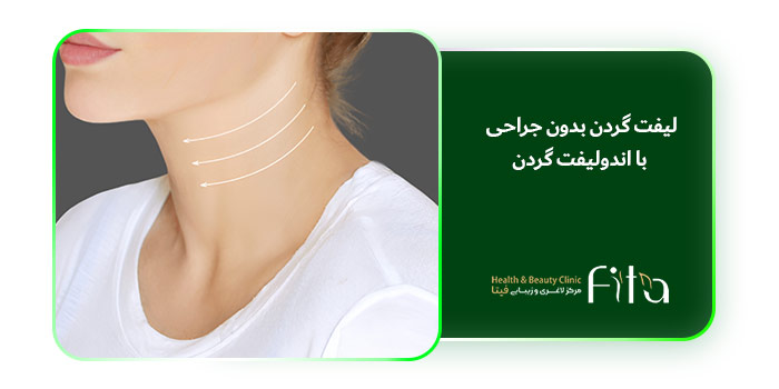 لیفت گردن بدون جراحی با اندولیفت گردن