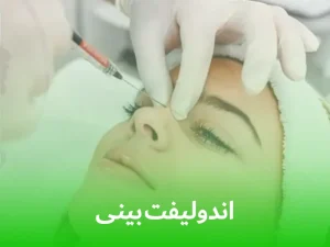 اندولیفت بینی