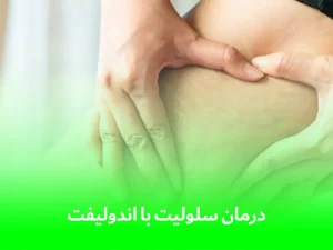 درمان سلولیت با اندولیفت