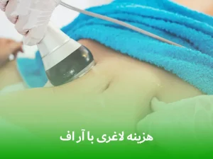 هزینه لاغری با آر اف