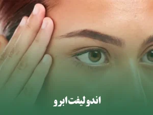 اندولیفت ابرو