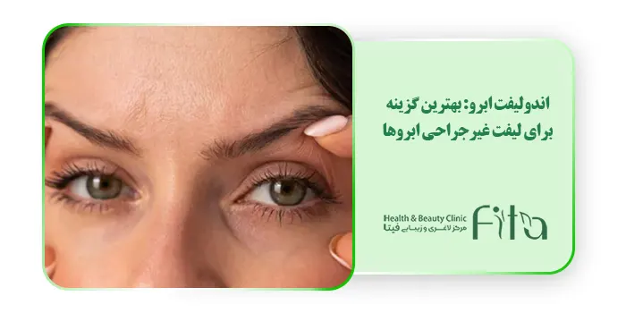 اندولیفت ابرو: بهترین گزینه برای لیفت غیرجراحی ابروها