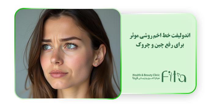 اندولیفت خط اخم روشی موثر برای رفع چین و چروک
