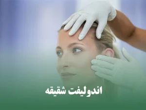 اندولیفت شقیقه
